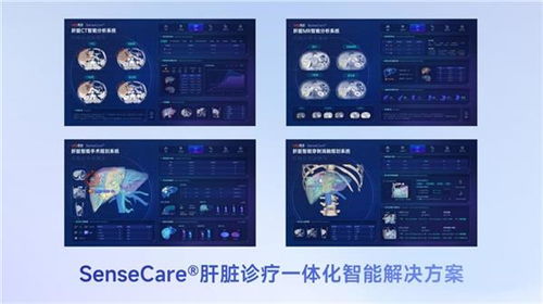 商湯醫(yī)療獲肝臟CT輔助診斷NMPA三類證，軟硬件零售賦能肝臟診療一體化新格局
